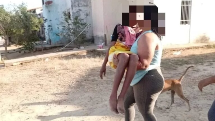 Horror en Guárico: Niña de 12 años fue ingresada a un hospital, quemaron su casa y lo que descubrieron fue siniestro